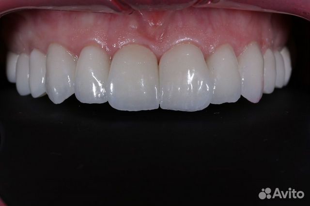 Зуботехническая лаборатория зубной техник