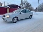 Chevrolet Lacetti 1.4 МТ, 2009, 118 282 км