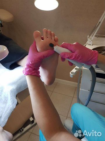 Медицинский педикюр